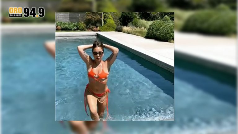 Lady Gaga está mostrando algo de piel.